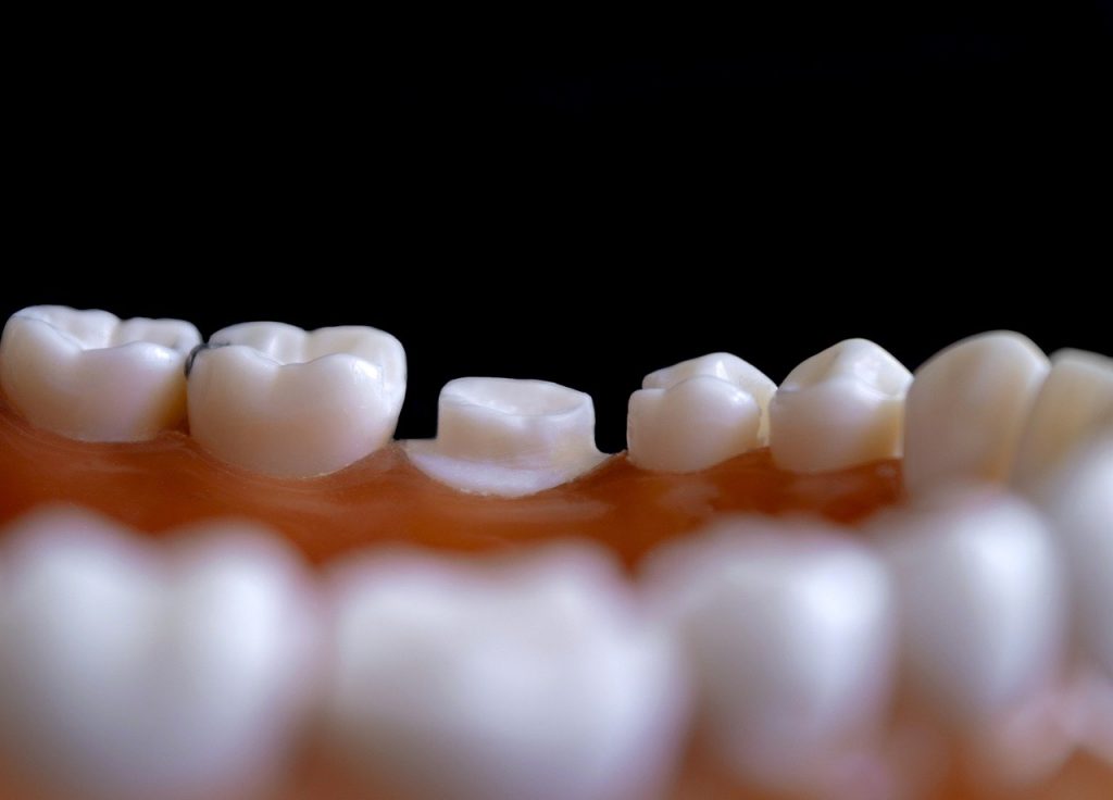 implantologia dental miraflores