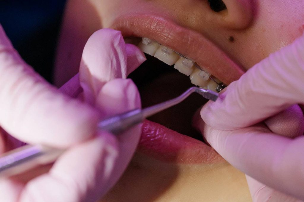 ortodoncia dental miraflores